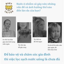 Thumbnail Bộ Lõi Lọc PP Type B Cho Vòi Sen Tắm Lọc Nước, Khử Khuẩn BABY TATTOO 1