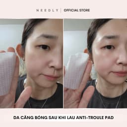 Thumbnail Combo Chăm Sóc Tóc Toàn Diện Mộc An 3 Sản Phẩm Chiết Xuất Thảo Mộc, Tóc Chắc Khoẻ Giảm Gãy Rụng 3