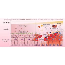Thumbnail Gel bôi nấm ngứa vùng kín FEMOXIL, sạch sâu se khít, hồng hào tự nhiên nhập khẩp danpharm, gói 3g 2