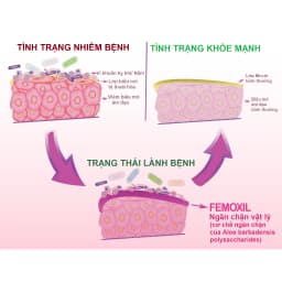 Thumbnail Gel bôi nấm ngứa vùng kín FEMOXIL, sạch sâu se khít, hồng hào tự nhiên nhập khẩp danpharm, gói 3g 3