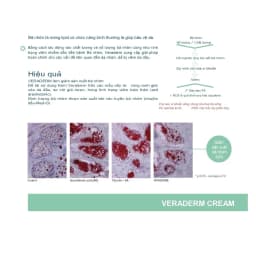 Thumbnail Kem bôi viêm da tiết bã nhờn VERADERM Danpharm tuýp 60g xuất xứ ISRAEL - POLIPHARM 2