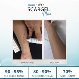 Thumbnail Kem Làm Mờ Sẹo DottorPrimo Scargel Plus - Duy Nhất Dùng Được Khi Vết Thương Còn Ướt 4