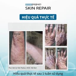 Thumbnail Kem Viêm Da Cơ Địa, Chàm Da, Eczema, Da Nứt Nẻ DottorPrimo Skin Repair (Tuýp 20-50ml) 2