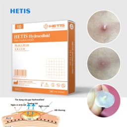 Thumbnail Miếng Dán Mụn, Vết Thương ALFASEPT HETIS HYDROCOLLOID Giúp Thấm hút Dịch, Loại Bỏ Những Mô Chết, Ngăn Ngừa Sẹo 2