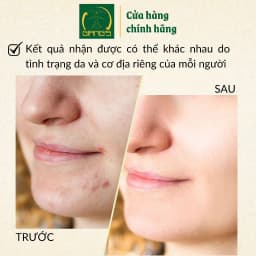 Thumbnail Nước cân bằng (toner) giàu khoáng dành cho da hỗ hợp JASMINUM HERBAL EXTRACT TONER ALCOHOL-FREE 200ml - Giang's 3