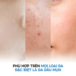 Thumbnail Nước dưỡng dành cho da mụn Tenamyd Cosmetic (140ml/chai) 4
