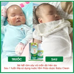 Thumbnail Nước tắm thảo dược cho bé Baby Clean 250ml giảm rôm sảy, hăm tã, làm sạch và mát cơ thể cho bé 4