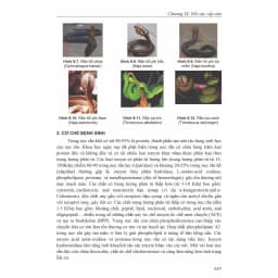 Thumbnail Sách - Bệnh học Nội khoa (Tập 1 + Tập 2) 1