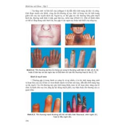 Thumbnail Sách - Bệnh học Nội khoa (Tập 1 + Tập 2) 2
