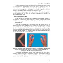 Thumbnail Sách - Bệnh học Nội khoa (Tập 1 + Tập 2) 3