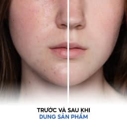 Thumbnail Sữa rửa mặt dành cho da dầu mụn Tenamyd Cosmetic (120g/tuýp) 3