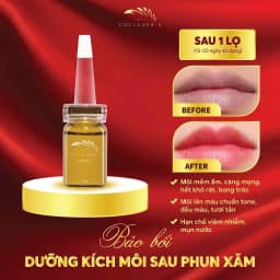 Thumbnail Tinh chất dưỡng kích màu môi sau phun xăm Vieskin GoldShine, collagen tươi kích màu sắc nét, tự nhiên, căng bóng, 7ml 4