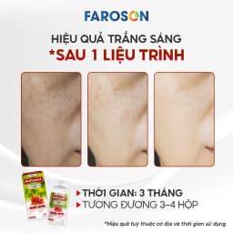 Thumbnail TPBVSK Viên Uống Trắng Da Glutathione Faroson Glutamax 1000 Hỗ Trợ Sáng Da Mờ Thâm Nám Chống Nắng Hộp 30 Viên 2