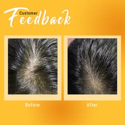 Thumbnail Muối gội tẩy tế bào chết da đầu, tóc chứa AHA BareSoul BLISS Hair Scrub 330g 2