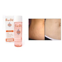 Thumbnail Tinh Dầu Rạn Da, Mờ Sẹo Bio-Oil Scar Treatment Cocolux 2