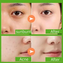 Thumbnail Gel lô hội PFFEE dưỡng ẩm phục hồi cháy nắng 300g 2