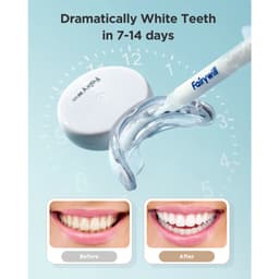 Thumbnail Bộ làm trắng răng Fairywill có đèn LED L6 4