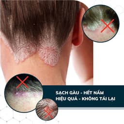 Thumbnail Combo 3 Dầu Gội Sạch Nấm DEGO PHARMA 80ml - Dứt Điểm Gàu Ngứa & Nấm Da Đầu - Chiết Xuất Thiên Nhiên 3