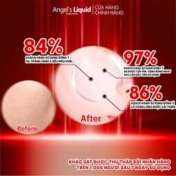 Thumbnail Nước Thần Dưỡng Trắng Se Khít Lỗ Chân Lông Angel's Liquid Glutathione +Niacinamide 700 Essence 150ml 4