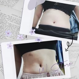 Thumbnail Gen Nịt Bụng Sau Phẫu Thuật Hút Mỡ - Định Hình Eo Giảm Mỡ - Latex Lưới Gymie WSTORE 25 Xương, Thông Hơi - Corset Chuẩn 3