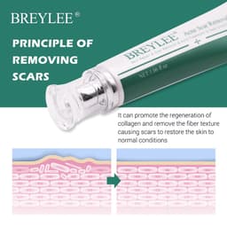 Thumbnail Kem xóa sẹo BREYLEE 30g hỗ trợ giảm sẹo mụn xóa vết rạn làm trắng da 3