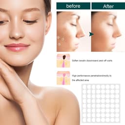 Thumbnail 120 Miếng dán loại bỏ mụn cóc/ nốt ruồi ANNIES chiết xuất thảo dược chân ngô thạch cao thiết kế vô hình 4