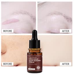 Thumbnail Tinh chất xóa sẹo VIBRANT GLAMOUR Sẹo, trị mụn, dưỡng ẩm cho da 30ml 2
