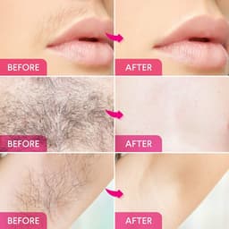 Thumbnail Miếng dán tẩy lông sáp ong Sumax gồm 8 miếng và 2 miếng bông lau sáp ong 4