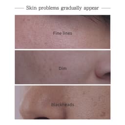 Thumbnail Set mỹ phẩm chăm sóc da LIYALAN tinh chất nghệ loại bỏ mụn dưỡng trắng hiệu quả 4