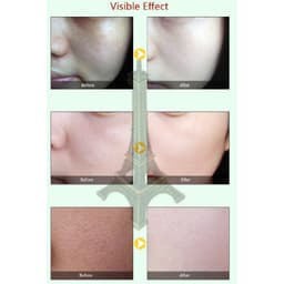 Thumbnail MeiYanQiong Mặt nạ Dưỡng Ẩm Se Khít Lỗ Chân Lông Chống Lão Hóa Kiểm Soát Dầu Và Trẻ Hóa 30Ml 4