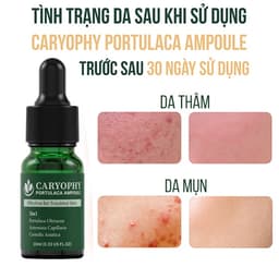 Thumbnail Combo Skincare chăm sóc da giảm mụn thâm Caryophy Portulaca (sữa rửa mặt 150ml + Toner 300ml + Serum 30ml) 3