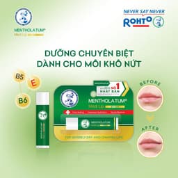 Thumbnail Son dưỡng môi chuyên biệt dành cho môi khô, nứt nẻ Mentholatum Medi Lip Stick 4.3g 2