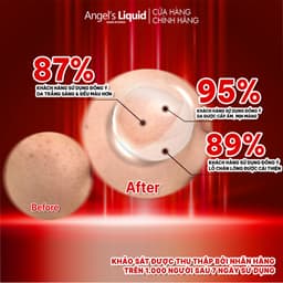 Thumbnail Bộ Sản Phẩm Serum, Kem Dưỡng Trắng Se Khít Lỗ Chân Lông Angel's Liquid Glutathione Plus Niacinamide Serum & Cream 4