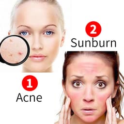 Thumbnail Gel lô hội PFFEE dưỡng ẩm phục hồi cháy nắng 300g 1