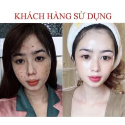 Thumbnail Serum giảm mụn thâm Seimy - Skin 7 Days Plus 10ml 4