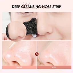 Thumbnail Miếng Dán Lột Mụn Đầu Đen Tiện Dụng O.TWO.O 2
