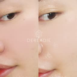 Thumbnail Bộ đôi làm sạch, cấp ẩm Nước tẩy trang Derladie 500ml, Toner Natural Witch Hazel 500ml 4