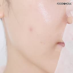 Thumbnail Combo 10 Mặt nạ giảm mụn, tái tạo da Foodaholic Retinol Anti Acnes Mask 23ml x 10 - RETINOL 3