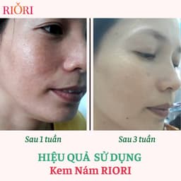 Thumbnail Kem Ngừa Nám RIORI HANA MELASMA COLLAGEN CREAM 30g (Mới) 2