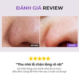 Thumbnail COSRX OFFICIAL Nước cân bằng BHA hỗ trợ làm giảm mụn đầu đen dung tích 50ml/ 100ml 4