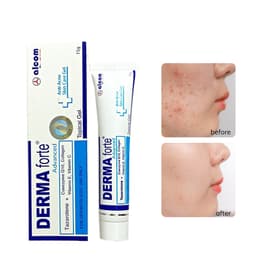 Thumbnail Gel Giảm Mụn, Thâm Sẹo Và Dưỡng Da Gamma DERMA FORTE Gel 15g 3