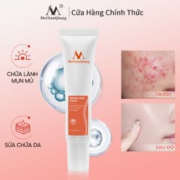 Thumbnail MeiYanQiong Kem dưỡng Hỗ Trợ Giảm Mụn cải thiện da thô ráp xỉn màu làm sáng màu da 15g 1