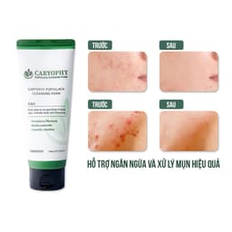 Thumbnail Bộ chăm sóc da mụn Caryophy portulaca (sữa rửa mặt 150ml toner 300ml) 4
