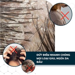 Thumbnail Combo 3 Dầu Gội Sạch Nấm DEGO PHARMA 80ml - Dứt Điểm Gàu Ngứa & Nấm Da Đầu - Chiết Xuất Thiên Nhiên 4