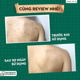 Thumbnail Sữa Tắm Giảm Mụn Lưng AHA BHA PHA 30 Days Miracle Acne Clear Body Cleanser Some By Mi 400g 1