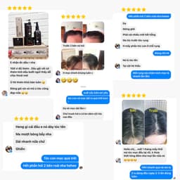 Thumbnail Bộ sản phẩm dầu gội thảo dược+ xịt bưởi kích mọc+ kem ủ tóc tráng gương combo 5 vyvyhaircare V 645ml / 680ml 4
