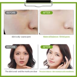 Thumbnail Sữa Rửa Mặt LAIKOU 120g Chiết Xuất Trà Xanh Kiềm Dầu Chăm Sóc Da Hiệu Quả 3