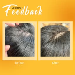 Thumbnail Muối gội tẩy tế bào chết da đầu, tóc BareSoul FREE Hair Scrub 330g 2