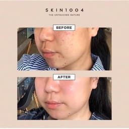 Thumbnail Tinh Chất Rau Má Skin1004 Madagascar Centella Asiatica 100 Ampoule 3