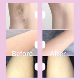 Thumbnail Dụng cụ tẩy lông nano PFFEE không đau tiện lợi 1